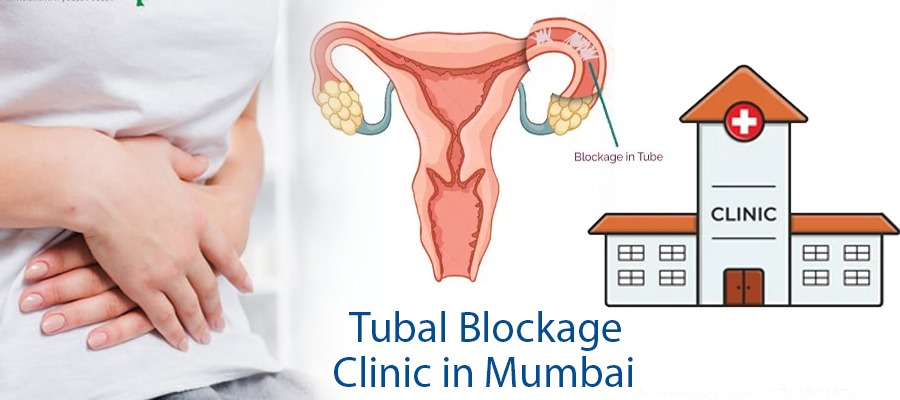 Tube Blockage Clinic in Mumbai | Best Infertility Doctor in Mumbai – Aasha Ayurveda